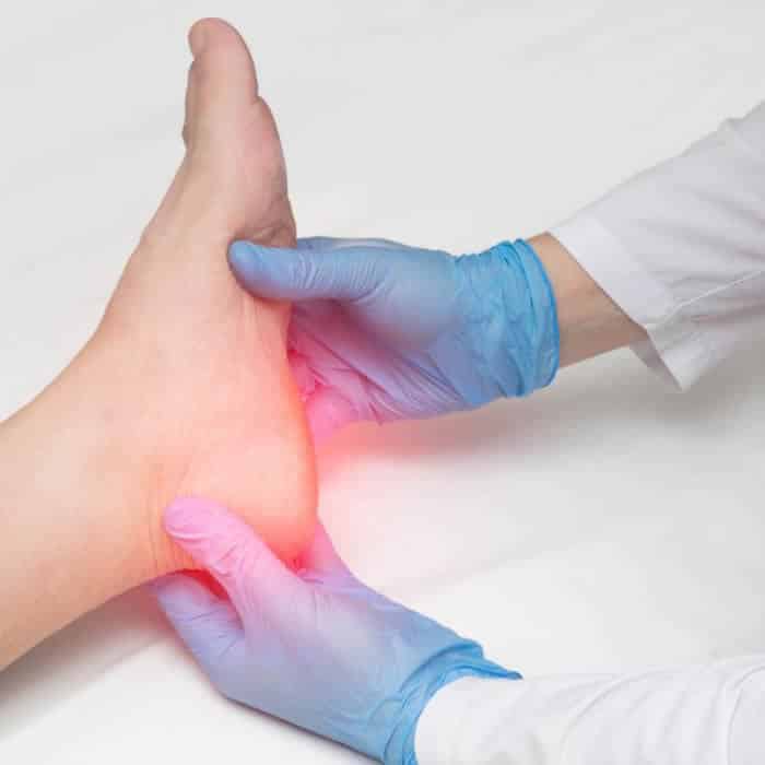 Plantar Fasciitis symptoms treatment